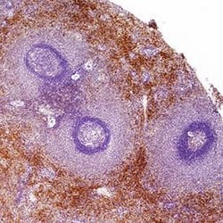 Human DNAM-1/CD226 Antibody, R D Systems 100 &mu;g; Unconjugated:Antibodies