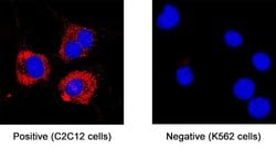 Mouse Semaphorin 3A Antibody, R D Systems 25 &mu;g | Buy Online | R&D Systems | Fisher Scientific