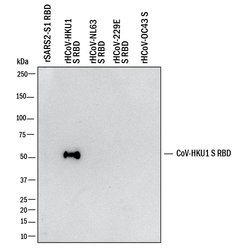 HCoV-HKU1 Human Coronavirus Spike RBD Antibody, R D Systems 25 &mu;g; Unconjugated:Antibodies,