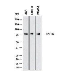 Human GPR107 Antibody, R D Systems:Antibodies:Primary Antibodies