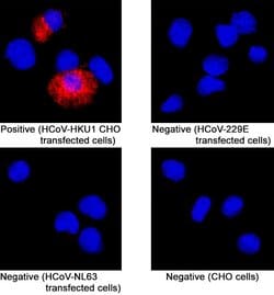HCoV-HKU1 Human Coronavirus Spike RBD Antibody, R D Systems:Antibodies:Primary
