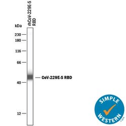 HCoV-229E Human Coronavirus Spike RBD Antibody, R D Systems 25 &mu;g; Unconjugated:Antibodies,