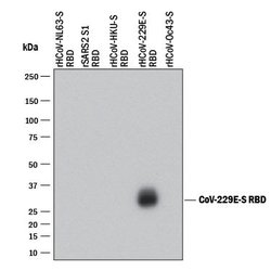 HCoV-229E Human Coronavirus Spike RBD Antibody, R D Systems 25 &mu;g; Unconjugated:Antibodies,