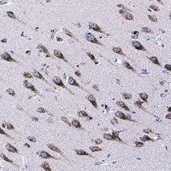 Human FFAR1/GPR40 Antibody, R D Systems 100 &mu;g; Unconjugated:Antibodies,