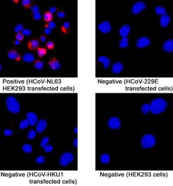 HCoV-NL63 Human Coronavirus Spike RBD Antibody, R D Systems 25 &mu;g; Unconjugated:Antibodies,