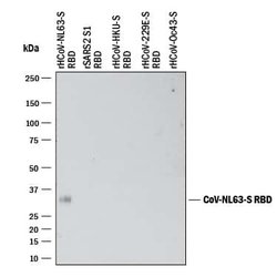 HCoV-NL63 Human Coronavirus Spike RBD Antibody, R D Systems 25 &mu;g; Unconjugated:Antibodies,