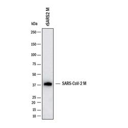 SARS-CoV-2 Membrane Antibody, R D Systems 100 &mu;g | Buy Online | R&D Systems | Fisher Scientific