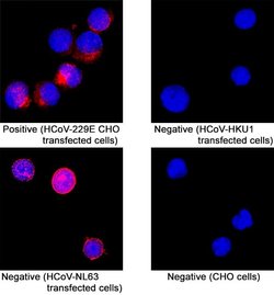 HCoV-229E Spike RBD Antibody, R D Systems 25 μg; Unconjugated:Antibodies,