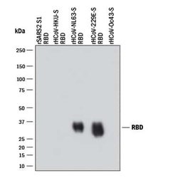 HCoV-229E Spike RBD Antibody, R D Systems 25 μg; Unconjugated:Antibodies,