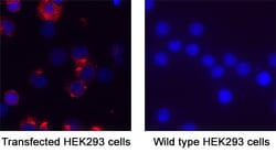 SARS-CoV-2 B.1.1.529 (Omicron BA.1) RBD Antibody, Novus Biologicals 25