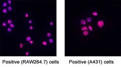 Human SLX4 Antibody, R D Systems 100 &mu;g; Unconjugated:Antibodies, Monoclonal