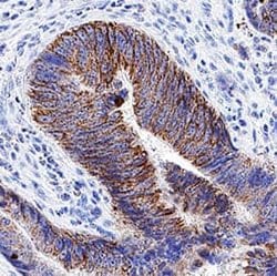 Human PTGDR Antibody, R D Systems:Antibodies:Primary Antibodies