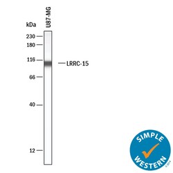 Human LRRC15 Antibody, R D Systems 25 &mu;g; Unconjugated:Antibodies, Monoclonal