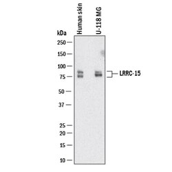 Human LRRC15 Antibody, R D Systems 25 &mu;g; Unconjugated:Antibodies, Monoclonal