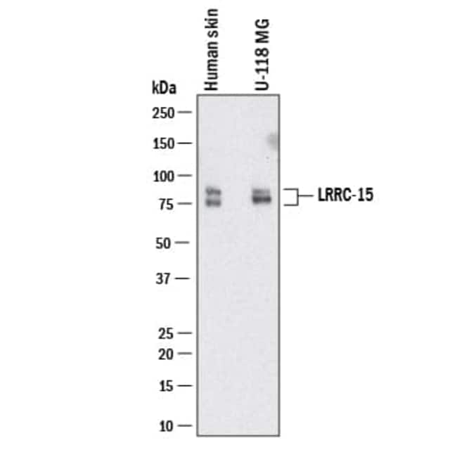 Human LRRC15 Antibody, R D Systems 25 μg; Unconjugated:Antibodies ...