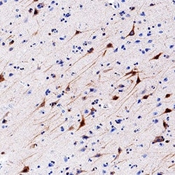Human GluR7/GRIK3 Antibody, R D Systems 100 &mu;g; Unconjugated:Antibodies,