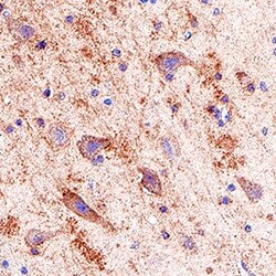 Human GluR2 Antibody, Novus Biologicals 25 &mu;g; Unconjugated:Antibodies,