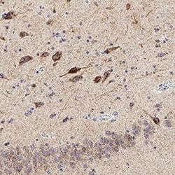 Human KA2/GRIK5 Antibody, R D Systems:Antibodies:Primary Antibodies