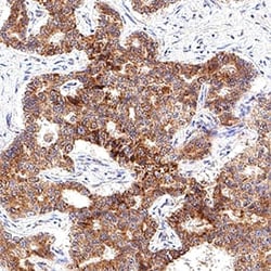 Human FGF basic/FGF2/bFGF Antibody, R D Systems:Antibodies:Primary Antibodies