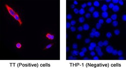 Human CGRP2 Antibody, R D Systems 100 &mu;g; Unconjugated:Antibodies, Monoclonal