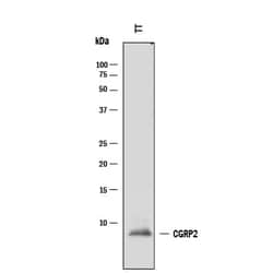 Human CGRP2 Antibody, R D Systems 100 &mu;g; Unconjugated:Antibodies, Monoclonal