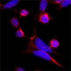 Human TSG101 Antibody, R D Systems:Antibodies:Primary Antibodies