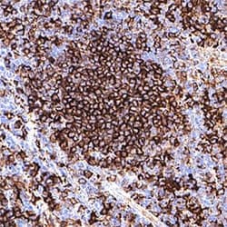 Human HLA-DR Antibody, R D Systems 100 &mu;g; Unconjugated:Anticorps, Monoclonal