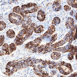 Human PIEZO2 Antibody, R D Systems 25 &mu;g; Unconjugated:Antibodies, Monoclonal