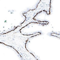 Human Cytokeratin 17 Antibody, R D Systems 100 &mu;g; Unconjugated:Antibodies,