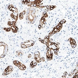 Human Cytokeratin 17 Antibody, R D Systems 100 &mu;g; Unconjugated:Antibodies,