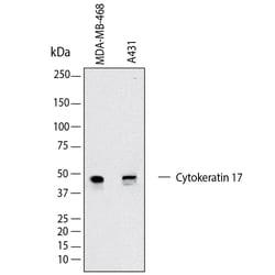 Human Cytokeratin 17 Antibody, R D Systems 100 &mu;g; Unconjugated:Antibodies,