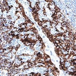 Human CKAP4/p63 Antibody, R D Systems 25 &mu;g; Unconjugated:Antibodies,