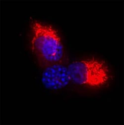 Human TOMM20 Antibody, R&D Systems&trade;