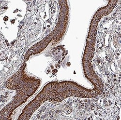 Human TOMM20 Antibody, R D Systems:Antibodies:Primary Antibodies