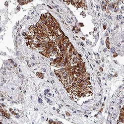 Human TOMM20 Antibody, R D Systems:Antibodies:Primary Antibodies