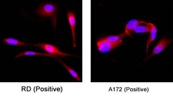 Human Desmin Antibody, R D Systems 100 &mu;g; Unconjugated:Antibodies,
