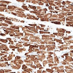 Human Desmin Antibody, R D Systems 100 &mu;g; Unconjugated:Antibodies,