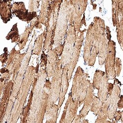 Human Desmin Antibody, R D Systems 100 &mu;g; Unconjugated:Antibodies,