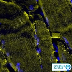Human Desmin Antibody, R D Systems 100 &mu;g; Unconjugated:Antibodies,