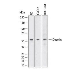 Human Desmin Antibody, R D Systems 100 &mu;g; Unconjugated:Antibodies,