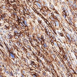 Human B7-H3 Antibody, R D Systems 100 &mu;g; Unconjugated:Antibodies, Monoclonal
