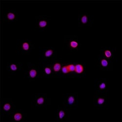 Mouse Ki67/MKI67 Antibody, R D Systems 25 &mu;g; Unconjugated:Antibodies,