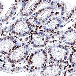 Mouse Ki67/MKI67 Antibody, R&D Systems™