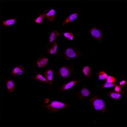 Human Exosome Component 9 Antibody, R D Systems 100 &mu;g; Unconjugated:Antibodies,