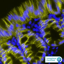Mouse EpCAM/TROP-1 Antibody, R D Systems 100 &mu;g; Unconjugated:Antikörper