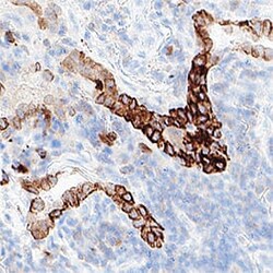 Human Cytokeratin 7 Antibody, R D Systems 25 &mu;g; Unconjugated:Antibodies,
