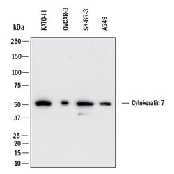 Human Cytokeratin 7 Antibody, R D Systems 25 &mu;g; Unconjugated:Antibodies,