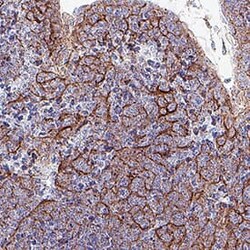 Mouse PD-L1/B7-H1 Antibody, R D Systems 100 &mu;g; Unconjugated:Anticuerpos