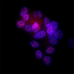 Human Cdk6 Antibody, R D Systems 25 &mu;g; Unconjugated:Antikörper