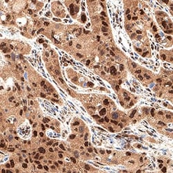 Human Cdk6 Antibody, R D Systems 25 &mu;g; Unconjugated:Antikörper